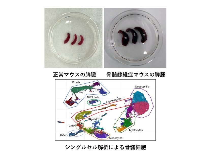 山本 幸也 造血器腫瘍の発症メカニズムの解明と新規治療法の開発